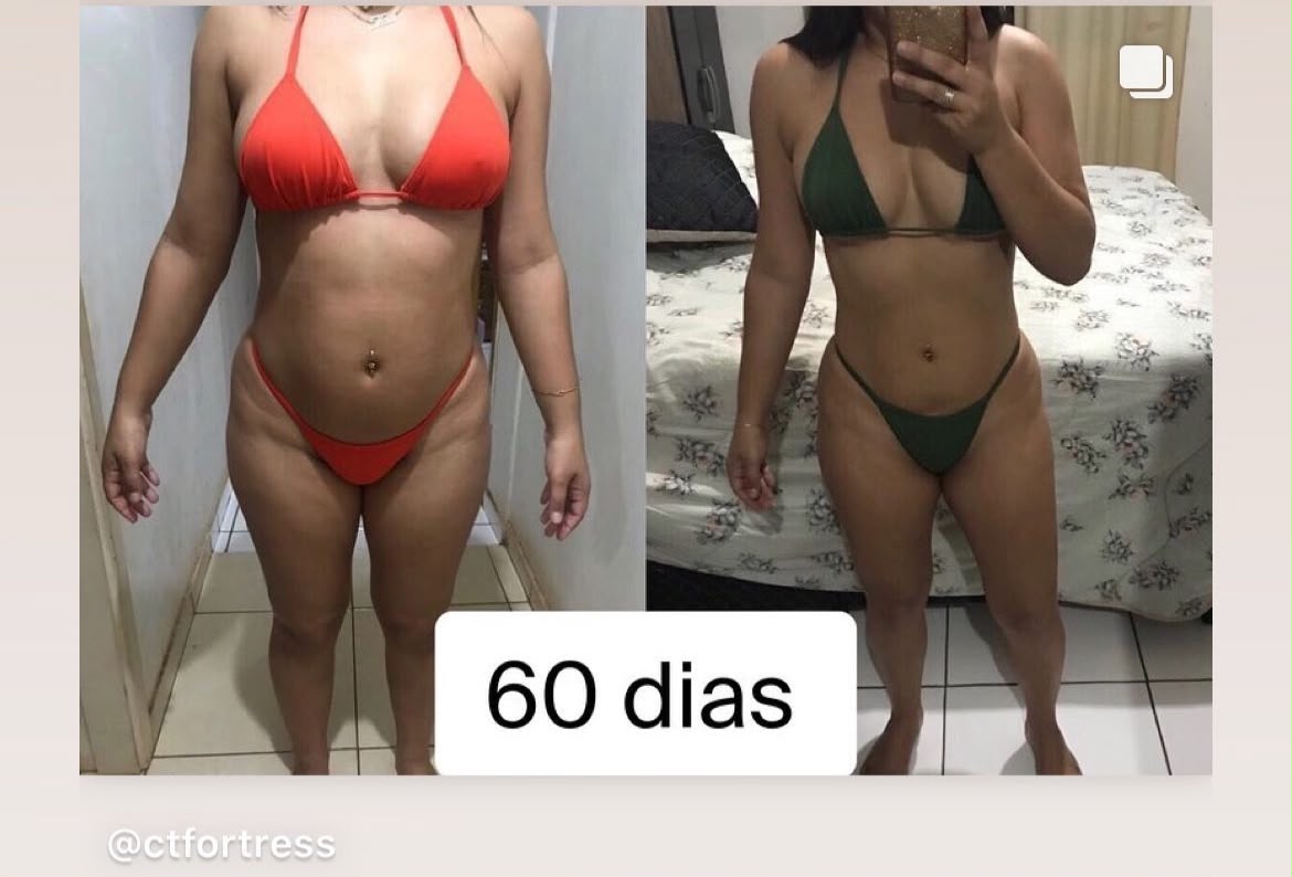 Resultado real